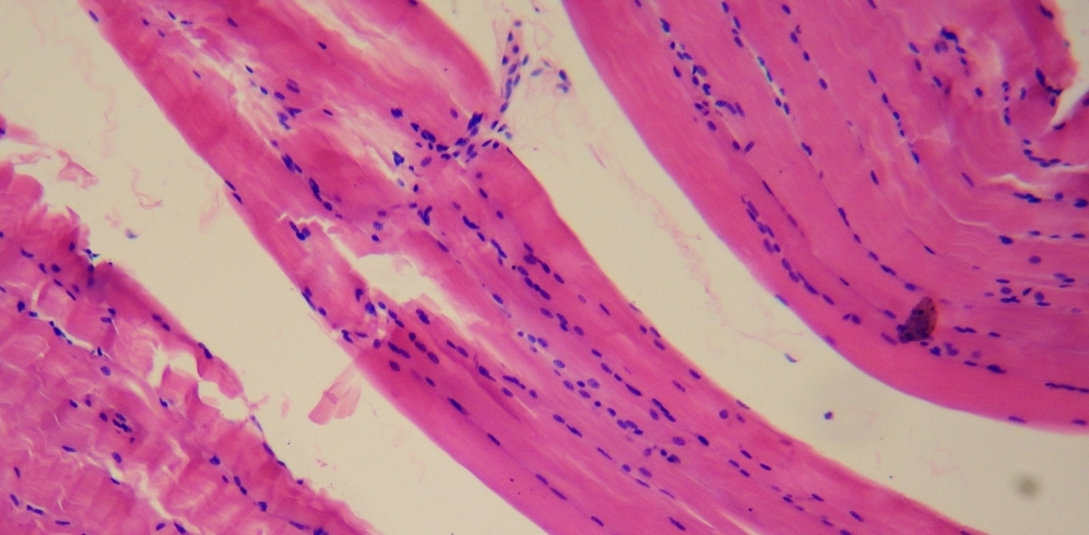 Smooth_muscle_tissue[1]